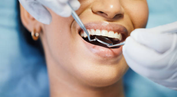Best Pediatric Emergency Dentist in Wedgefield, FL