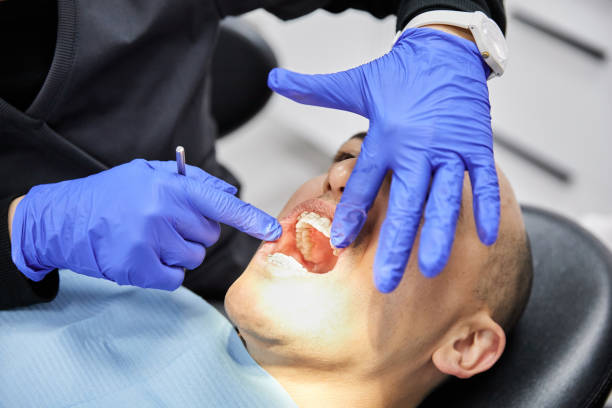 Best Emergency Tooth Extraction in Wedgefield, FL